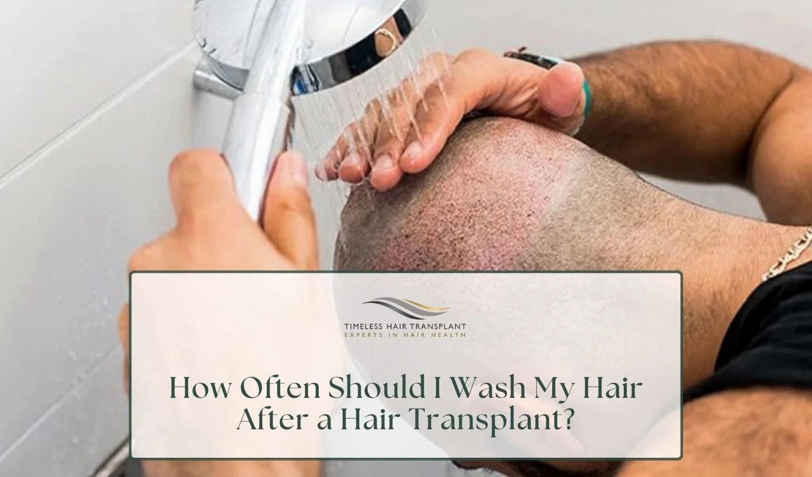 How Often Should I Wash My Hair After a Hair Transplant?