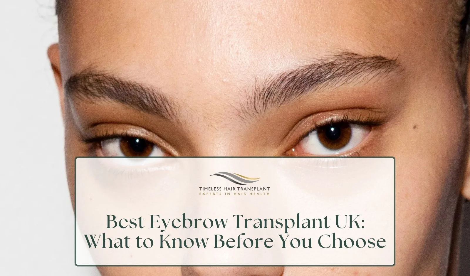 Best Eyebrow Transplant UK: What to Know Before You Choose