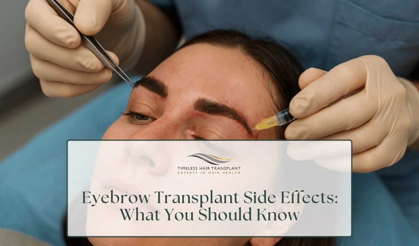 Eyebrow Transplant Side Effects: What You Should Know
