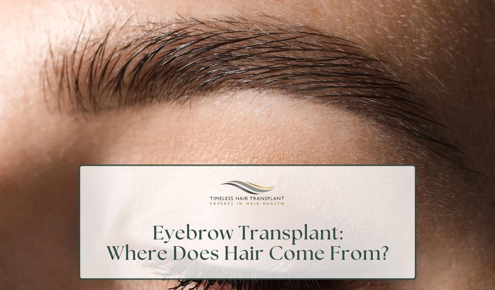 Eyebrow Transplant: Where Does Hair Come From?