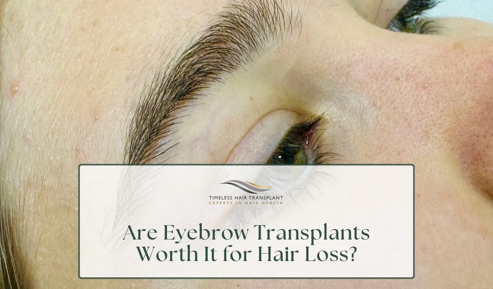 Are Eyebrow Transplants Worth It for Hair Loss?