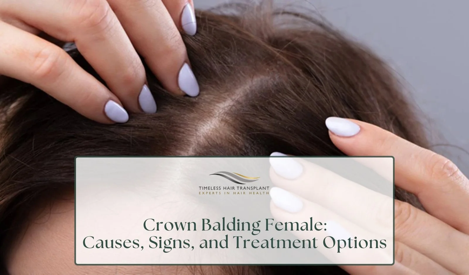 Crown Balding Female: Causes, Signs, and Treatment Options