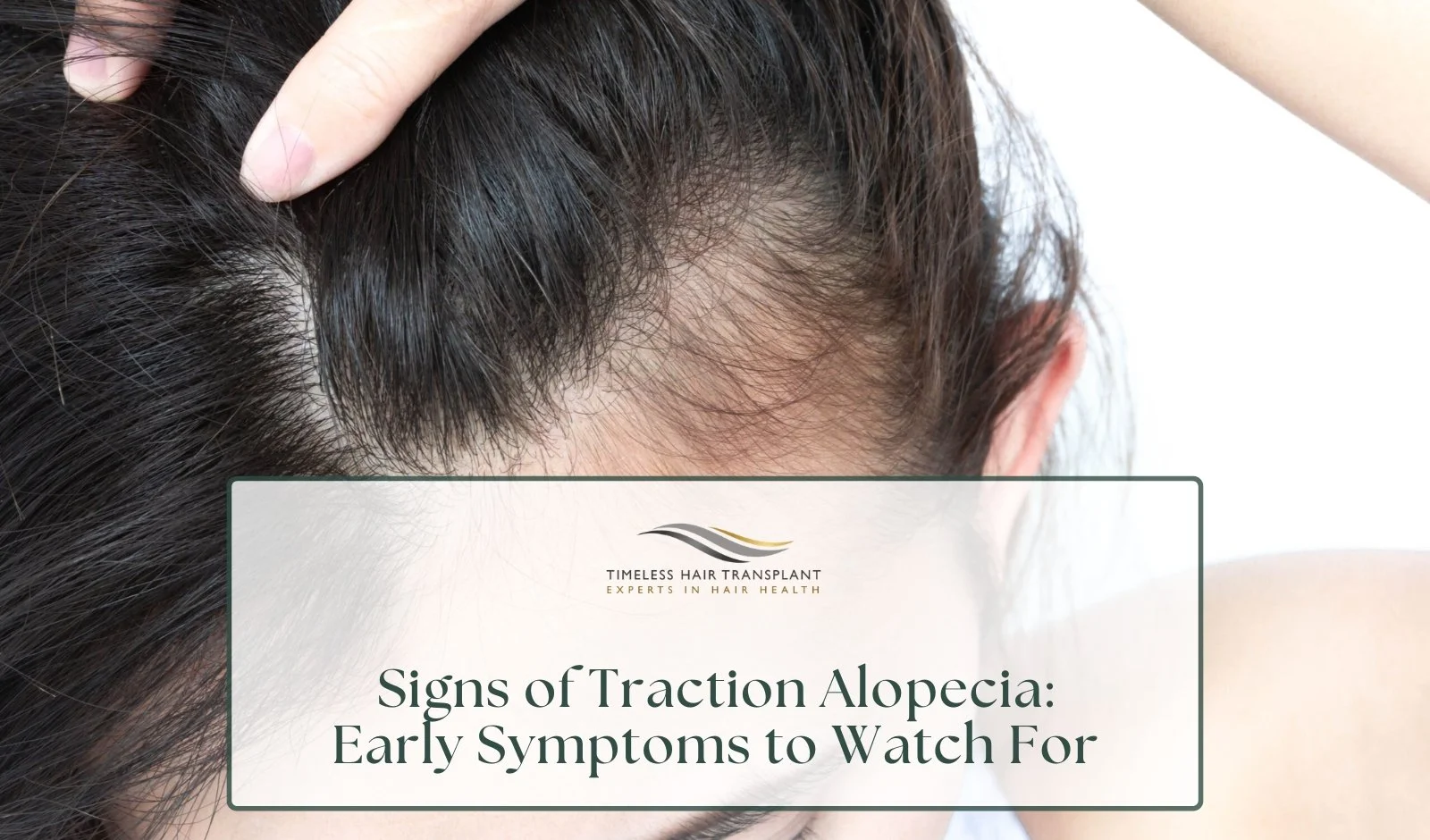 Signs of Traction Alopecia: Early Symptoms to Watch For