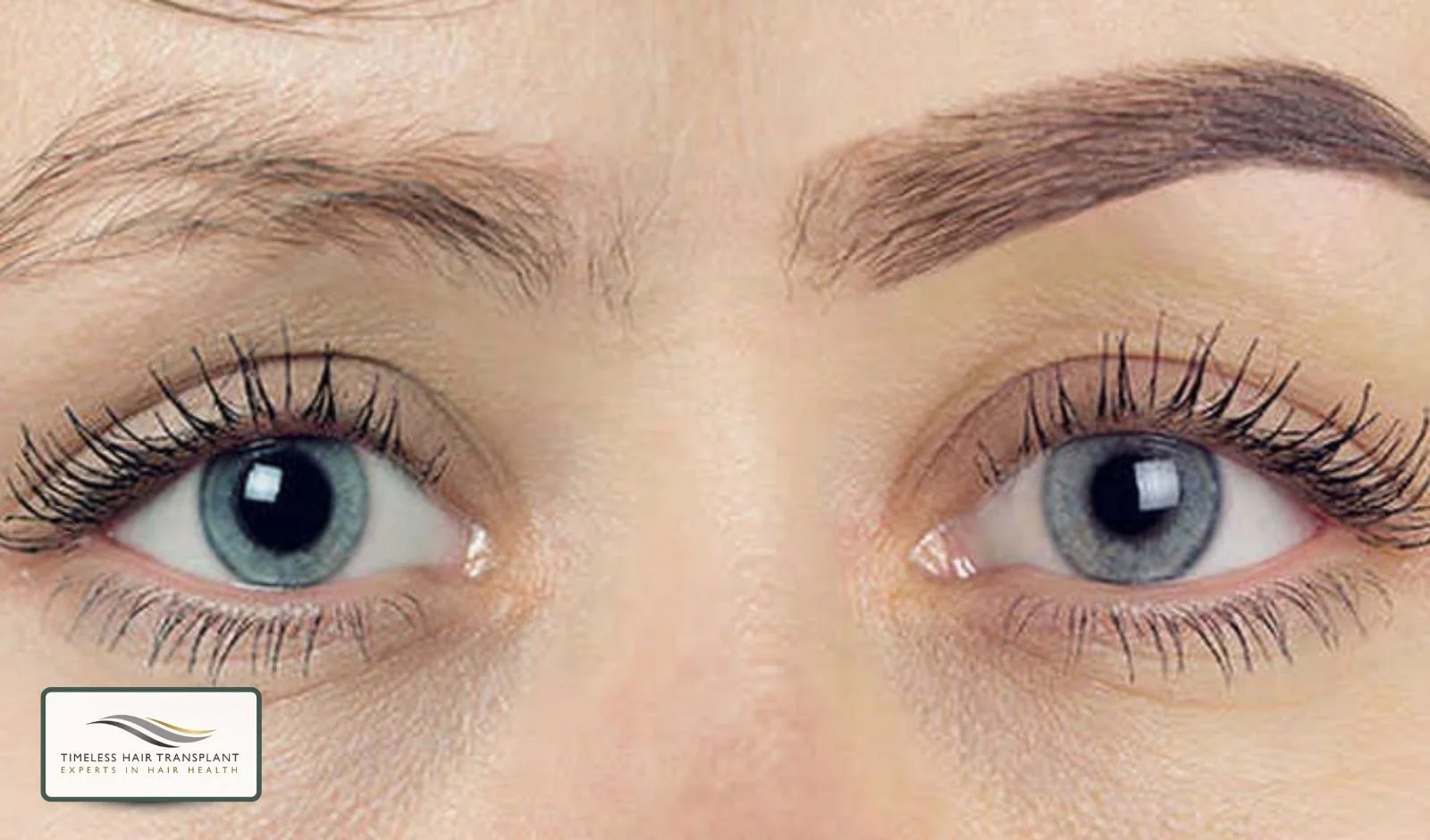 How Eyebrow Transplants Work
