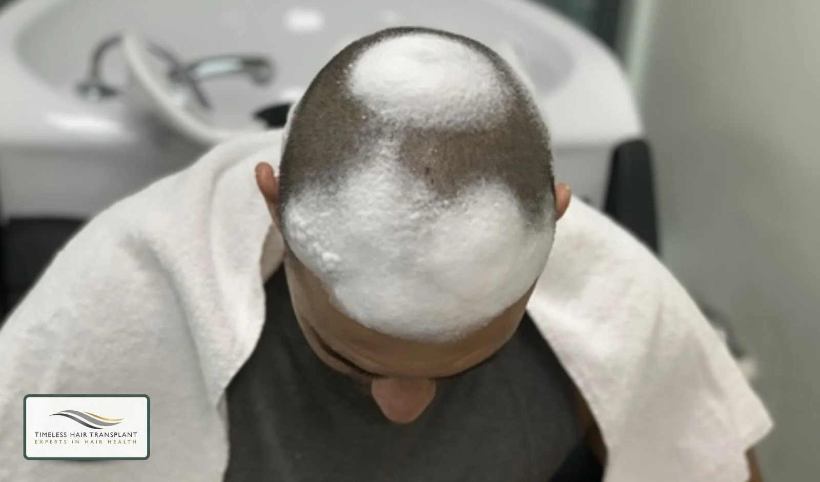 Shampoo and Hair Washing Technique