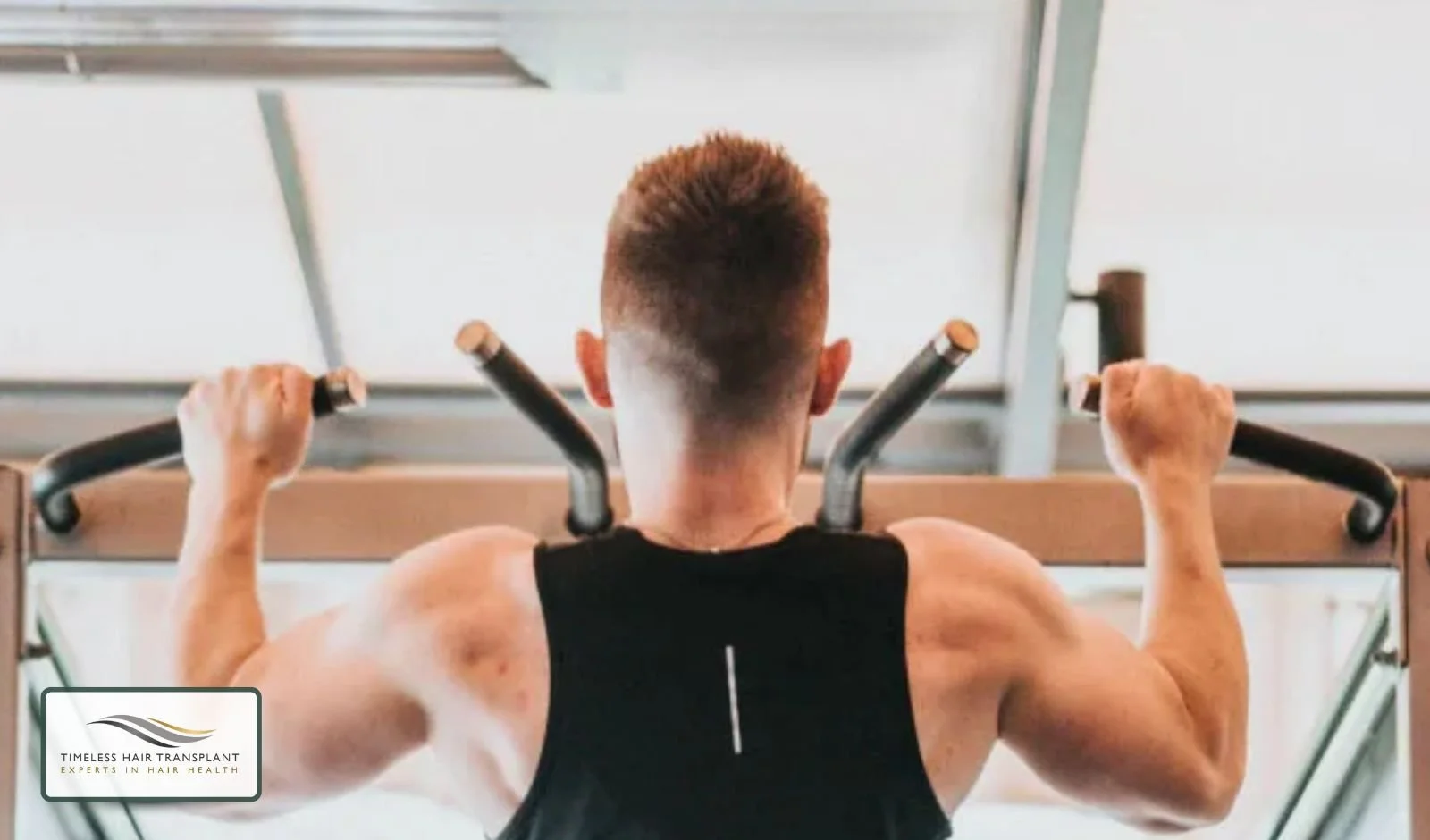 Can I Exercise After a Hair Transplant