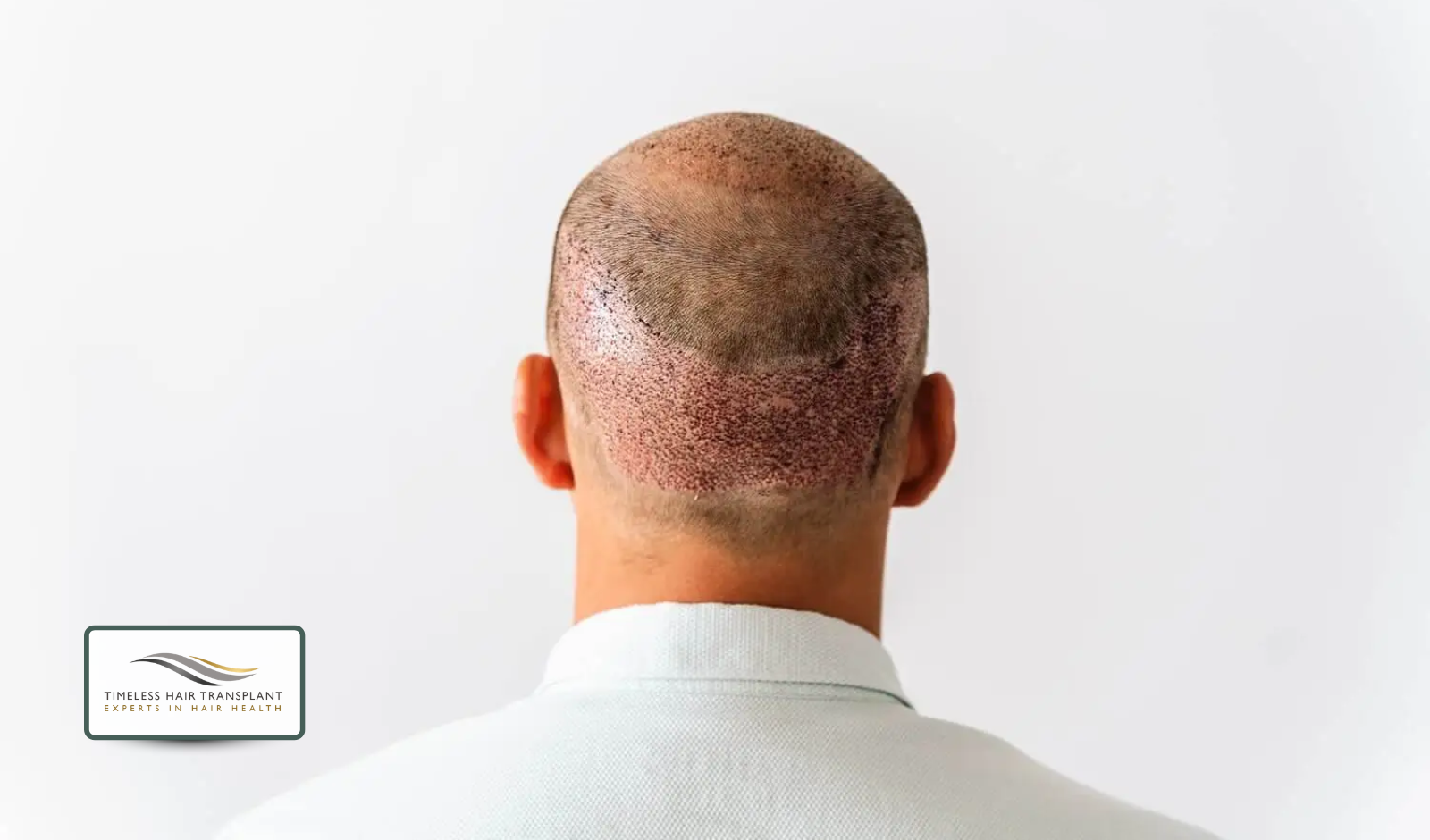 Donor Area Sensitivity.png