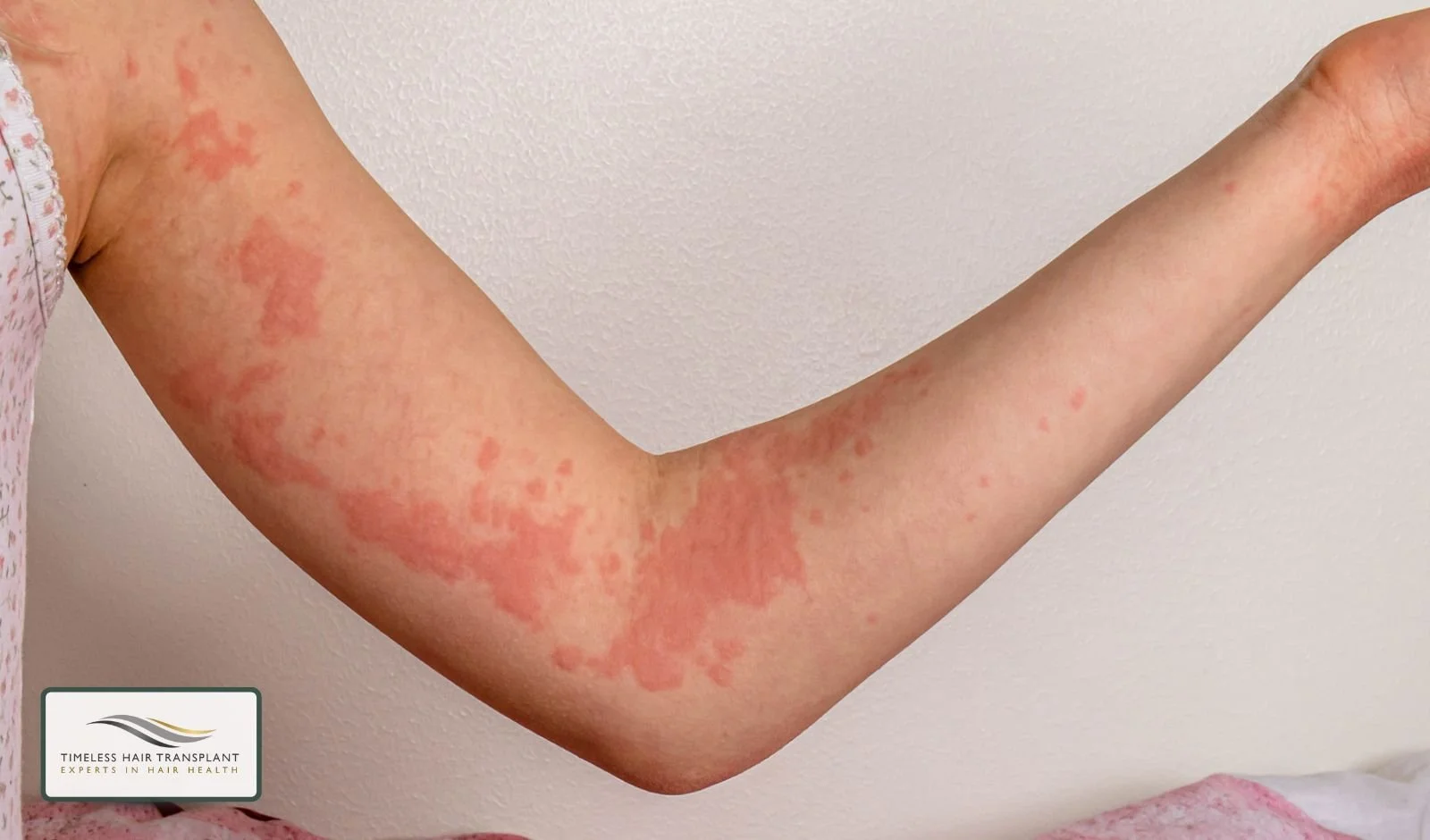 Less Common and Rare Side Effects