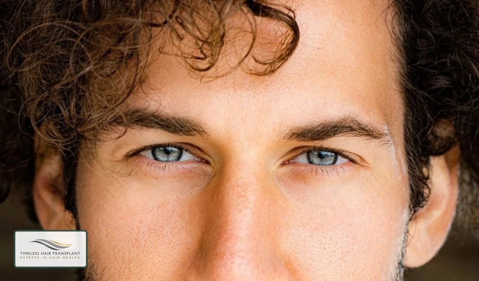 Why Transplanted Eyebrow Hair Continues to Grow