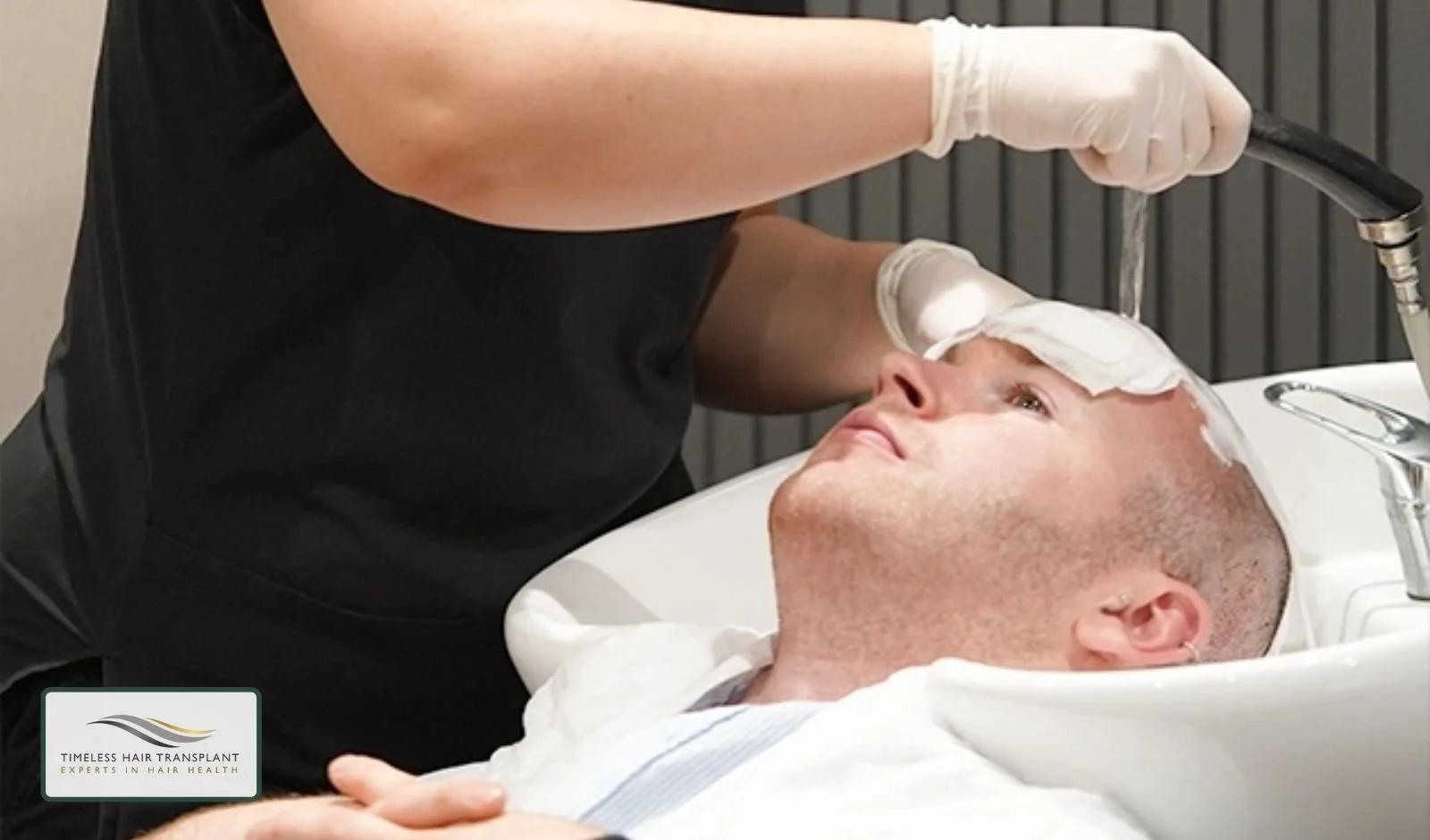 When Is the First Wash After FUE Hair Transplant