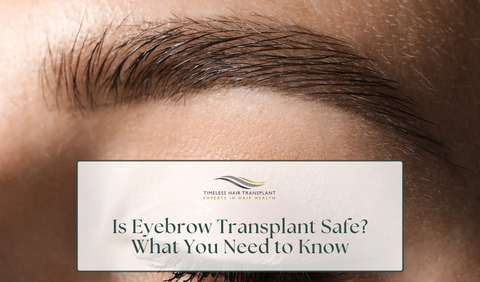 Is Eyebrow Transplant Safe What You Need to Know.jpg