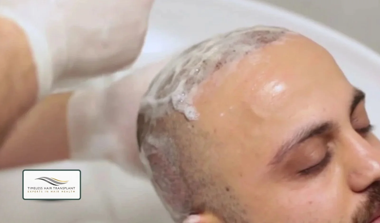 The Role of Proper Hair Washing