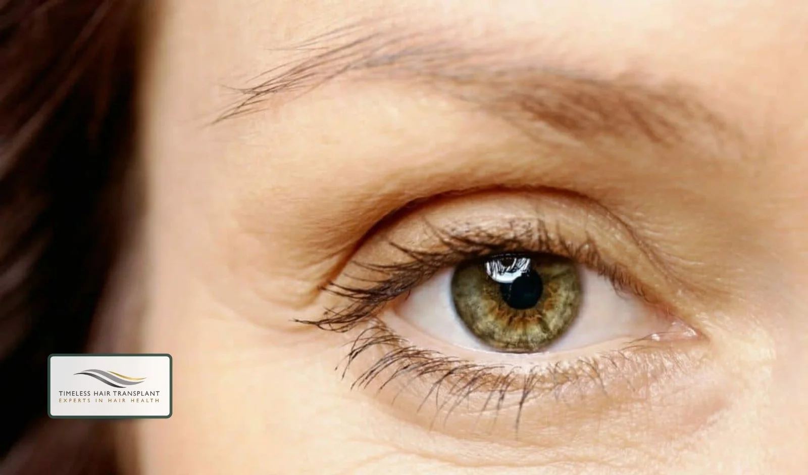 Temporary Hair Shedding.jpg