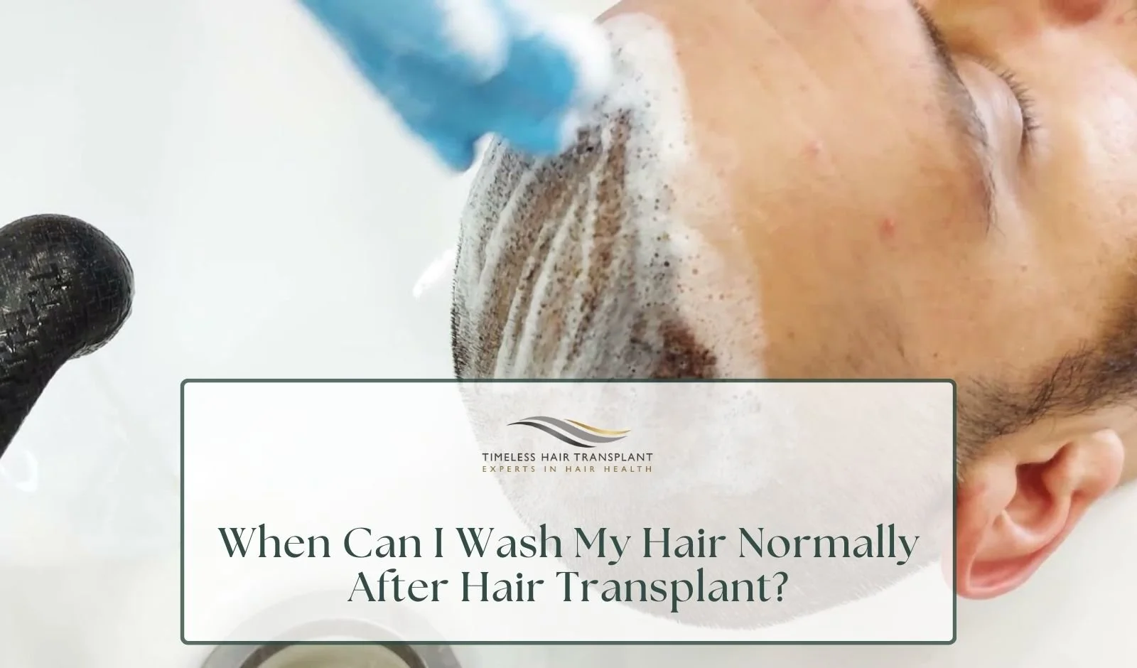 When Can I Wash My Hair Normally After Hair Transplant