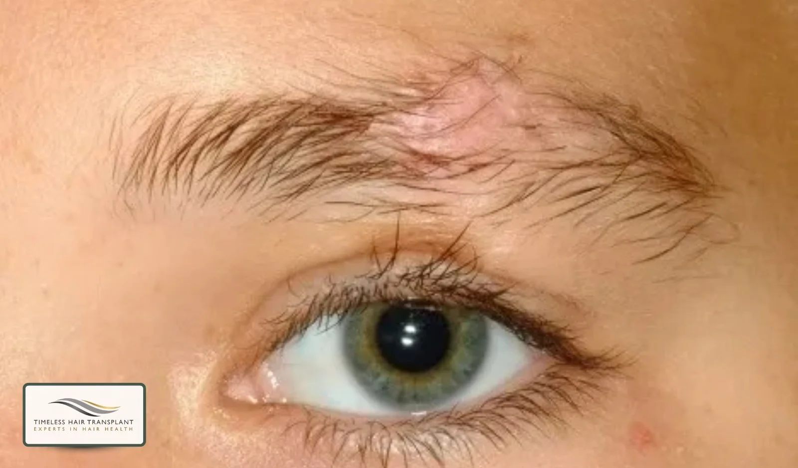 Who Is a Good Candidate.jpg