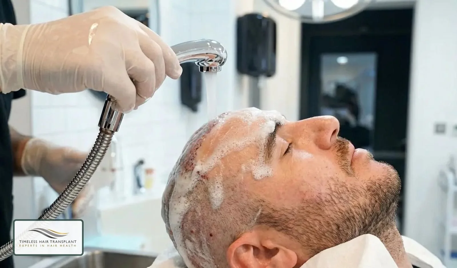 Best Shampoo After a Hair Transplant