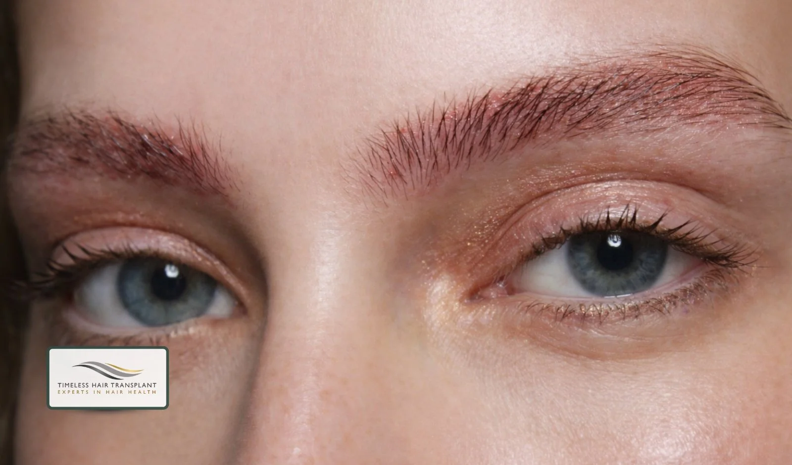 Managing Swelling and Discomfort.jpg