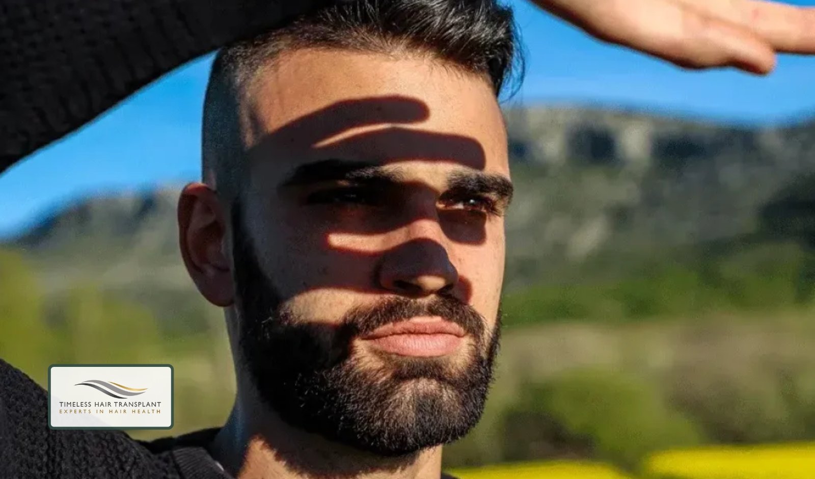 How Long Should You Avoid Sun Exposure After a Hair Transplant