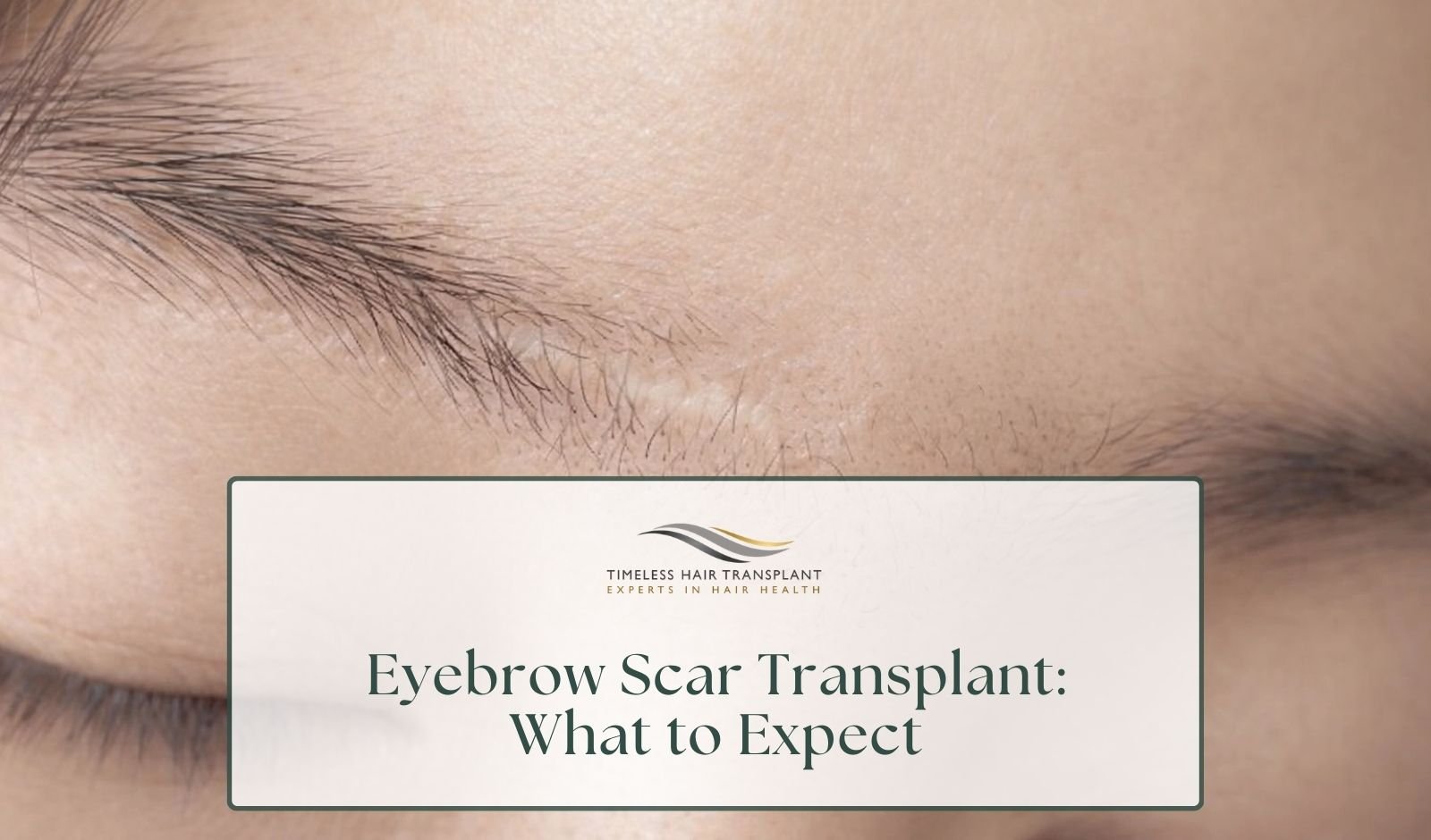 Eyebrow Scar Transplant What to Expect.jpg