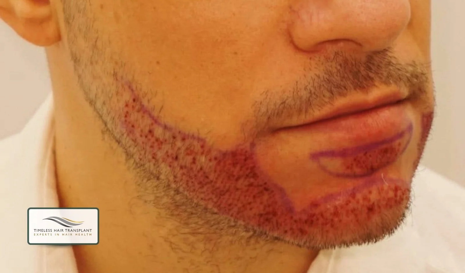 Managing Side Effects