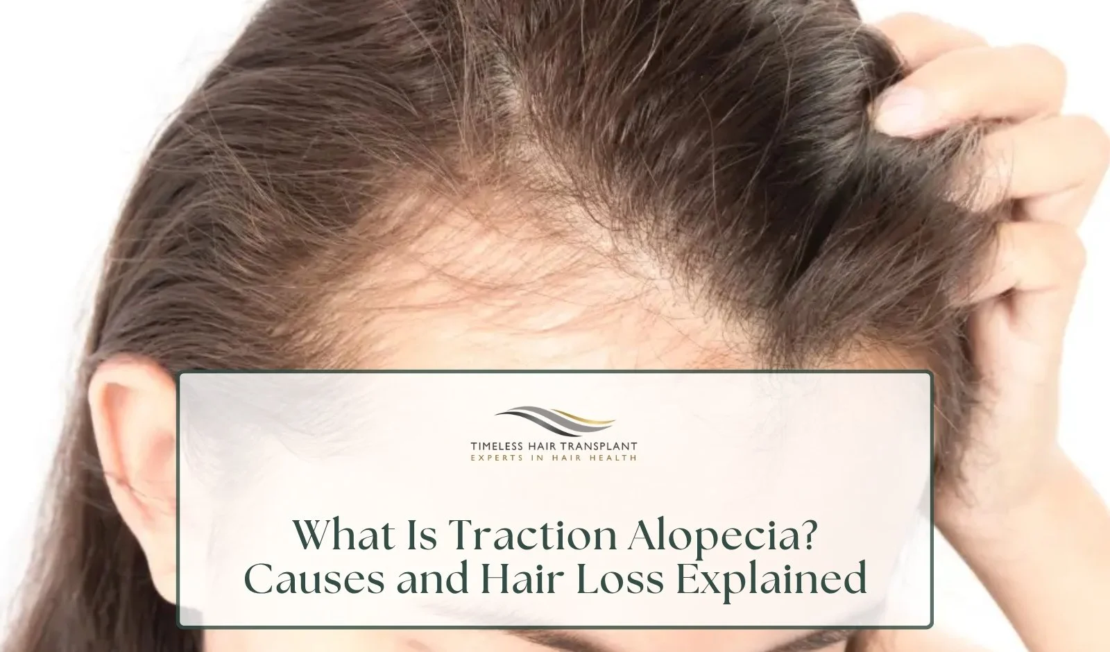 What Is Traction Alopecia Causes and Hair Loss Explained