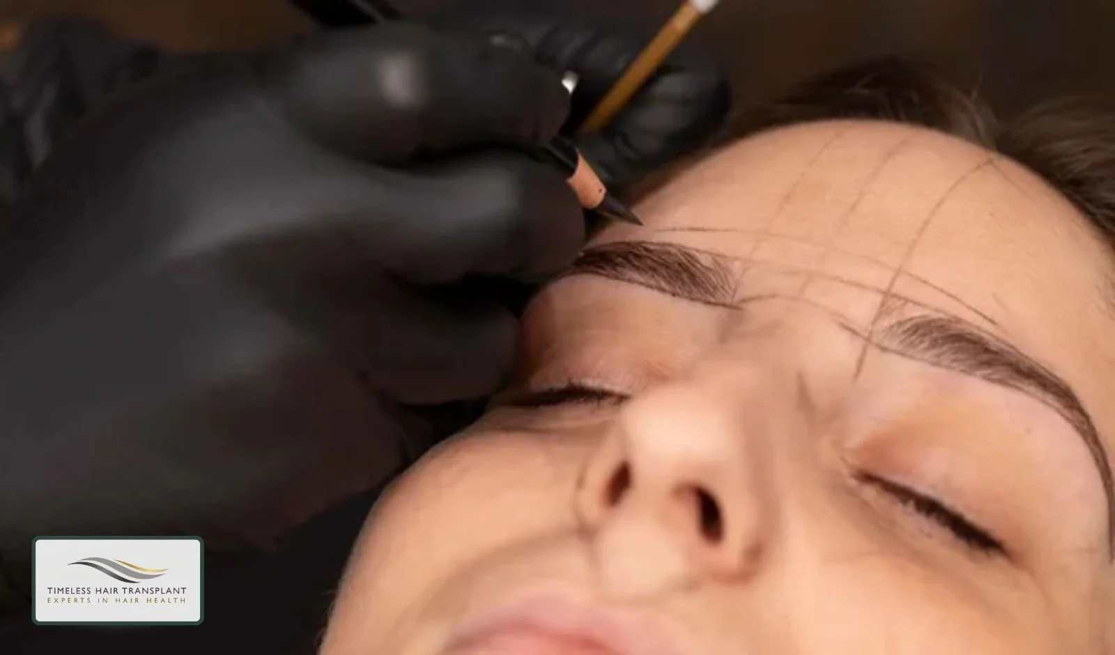 How Eyebrow Transplant Surgery Works