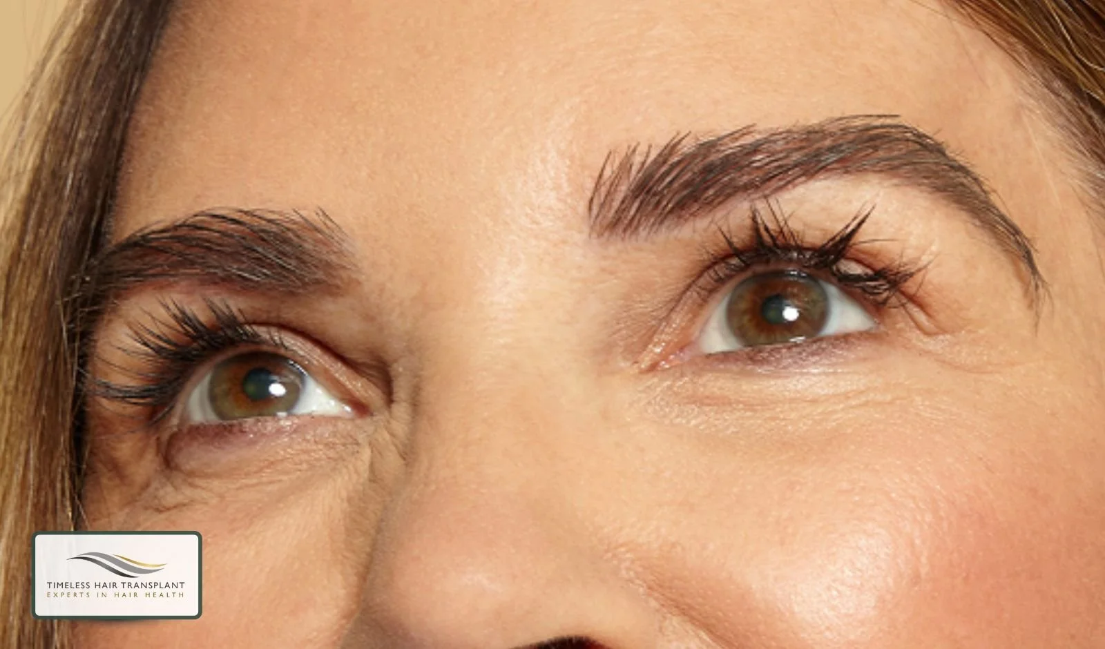 Does Transplanted Eyebrow Hair Grow Like Natural Hair