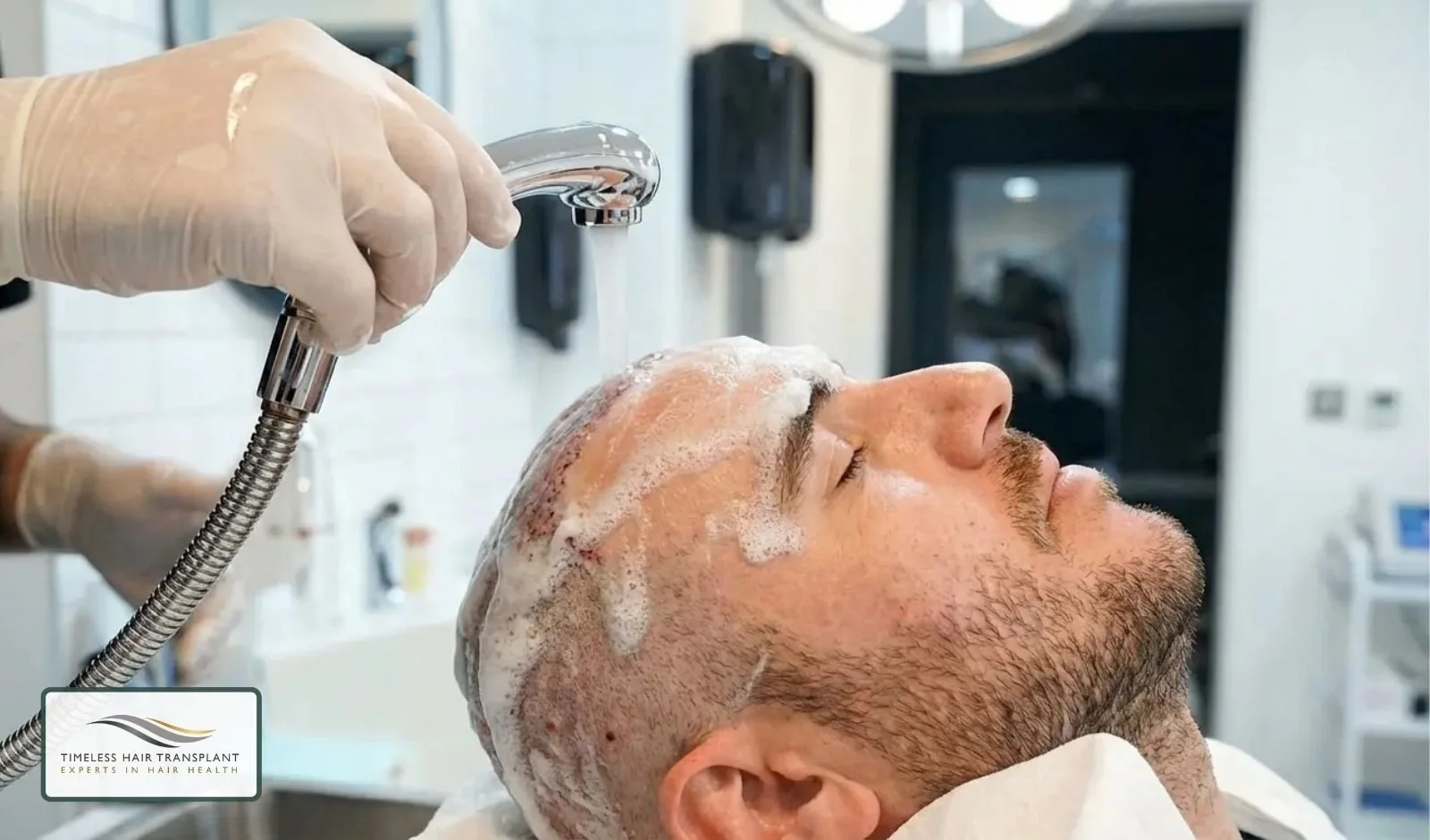 Why Shampoo Choice Matters After a Hair Transplant