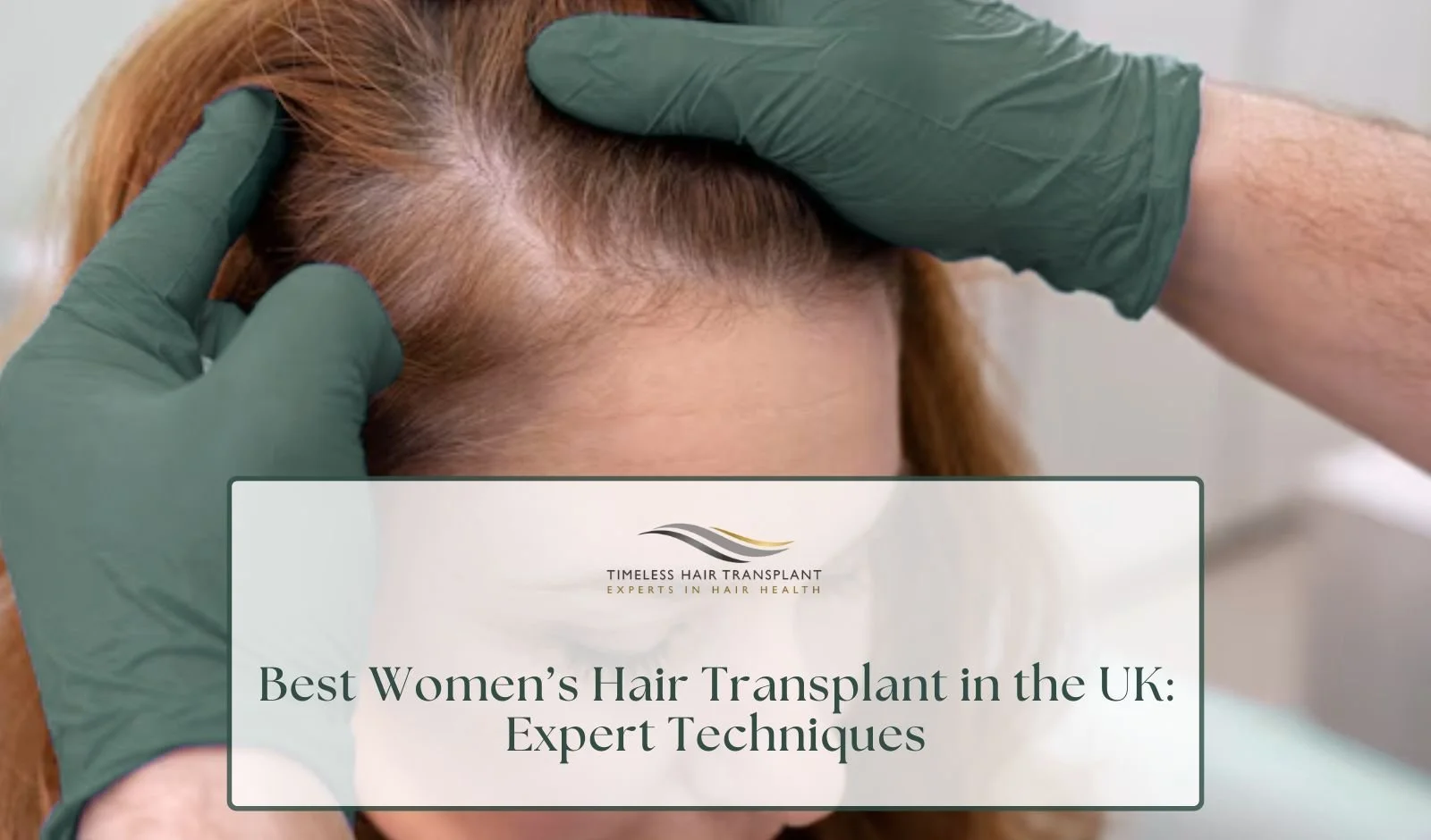 Best Women’s Hair Transplant in the UK Expert Techniques