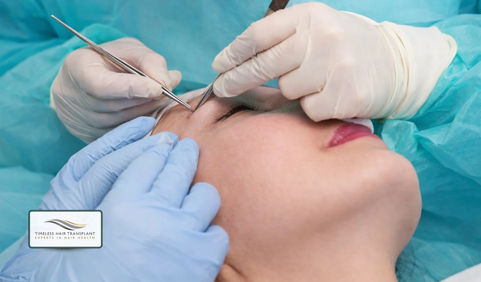 How the Eyebrow Transplant Procedure Works.jpg