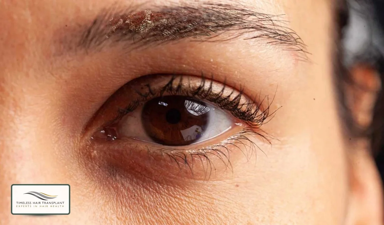 What Are the Possible Side Effects.jpg