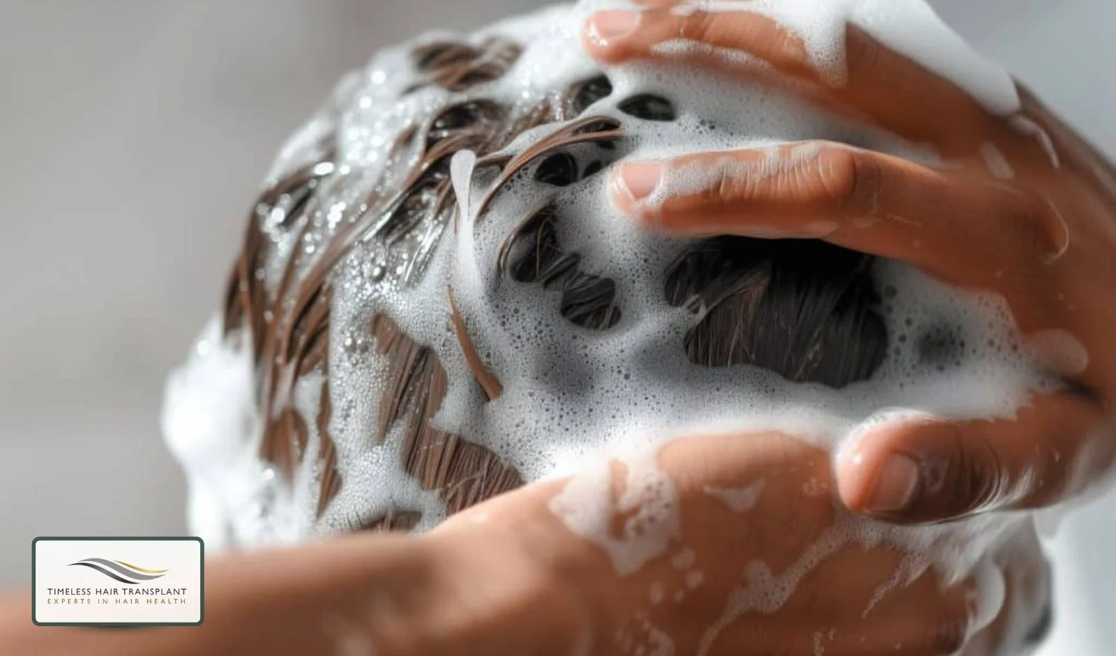 Should I Wash My Hair Everyday After Hair Transplant Surgery