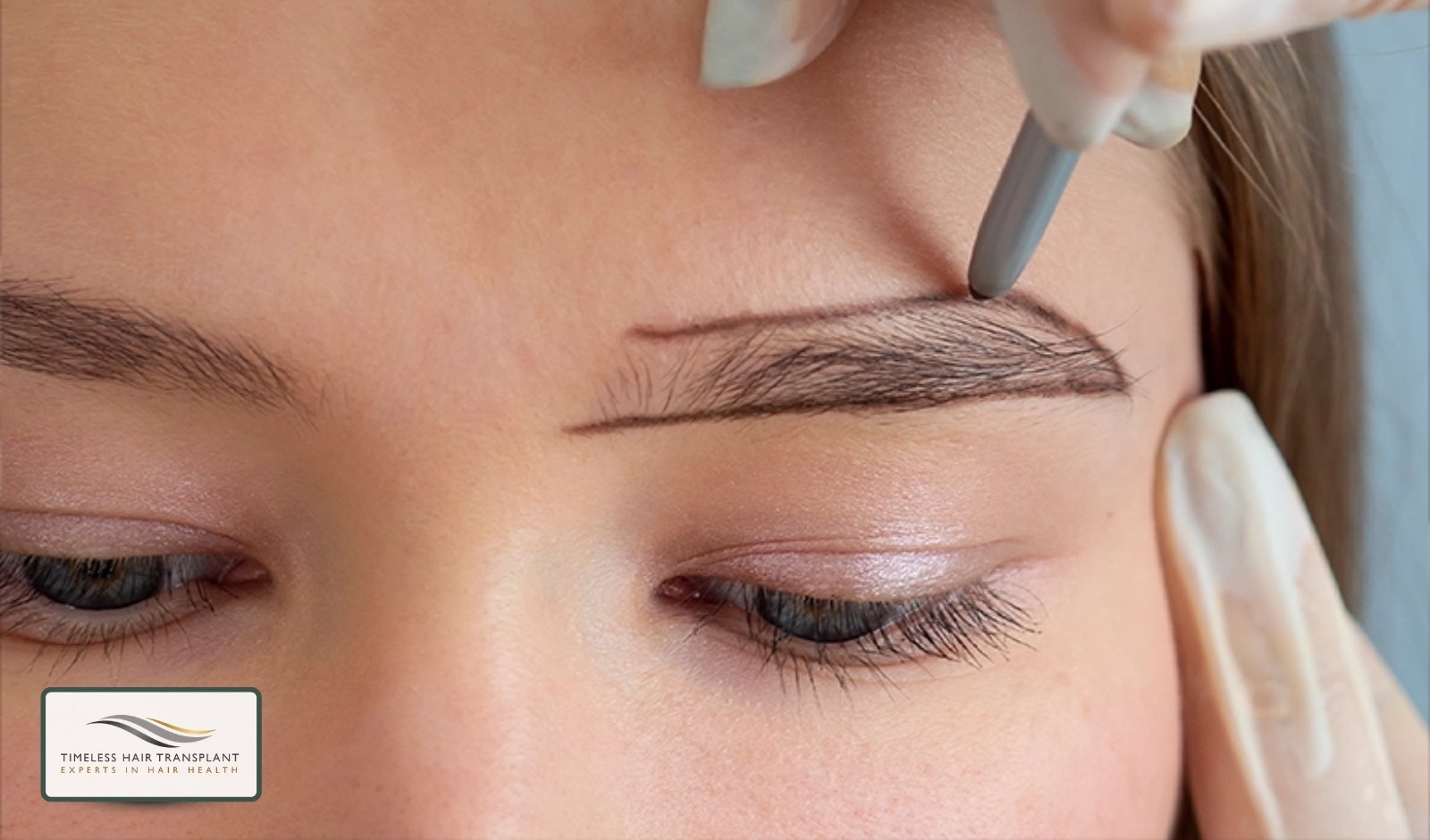 What Are Eyebrow Transplants