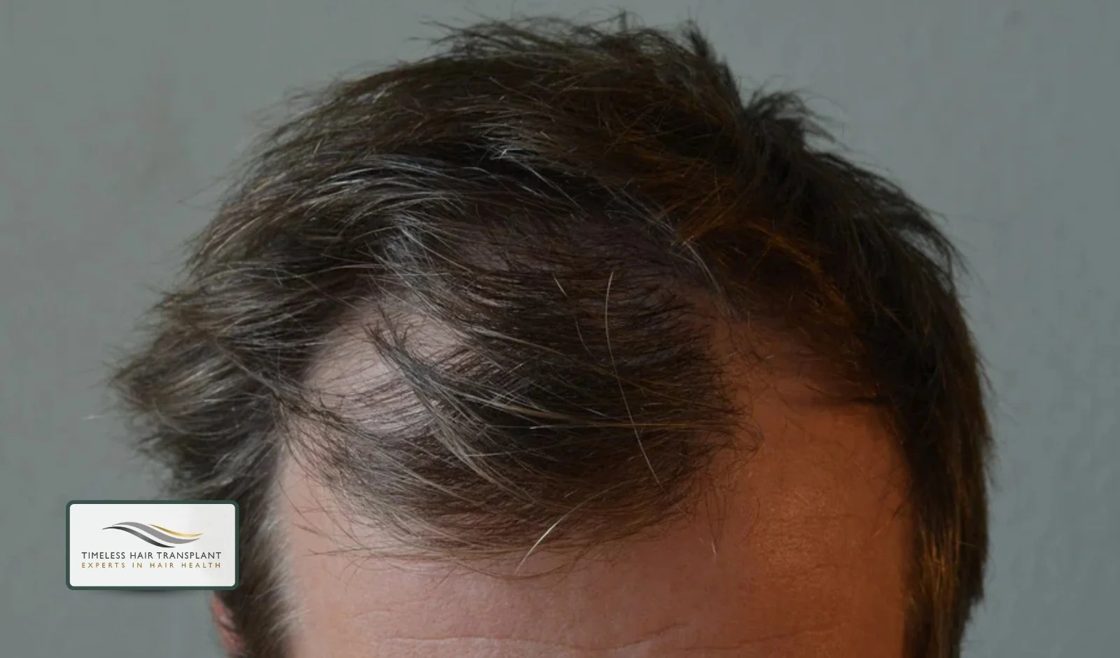 Common Signs and Symptoms