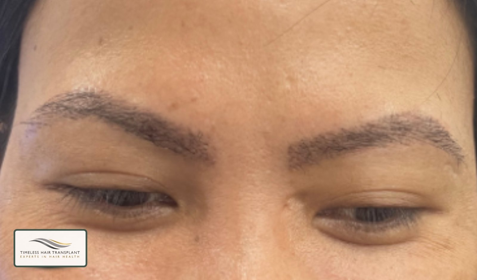 What Results Can You Expect.jpg