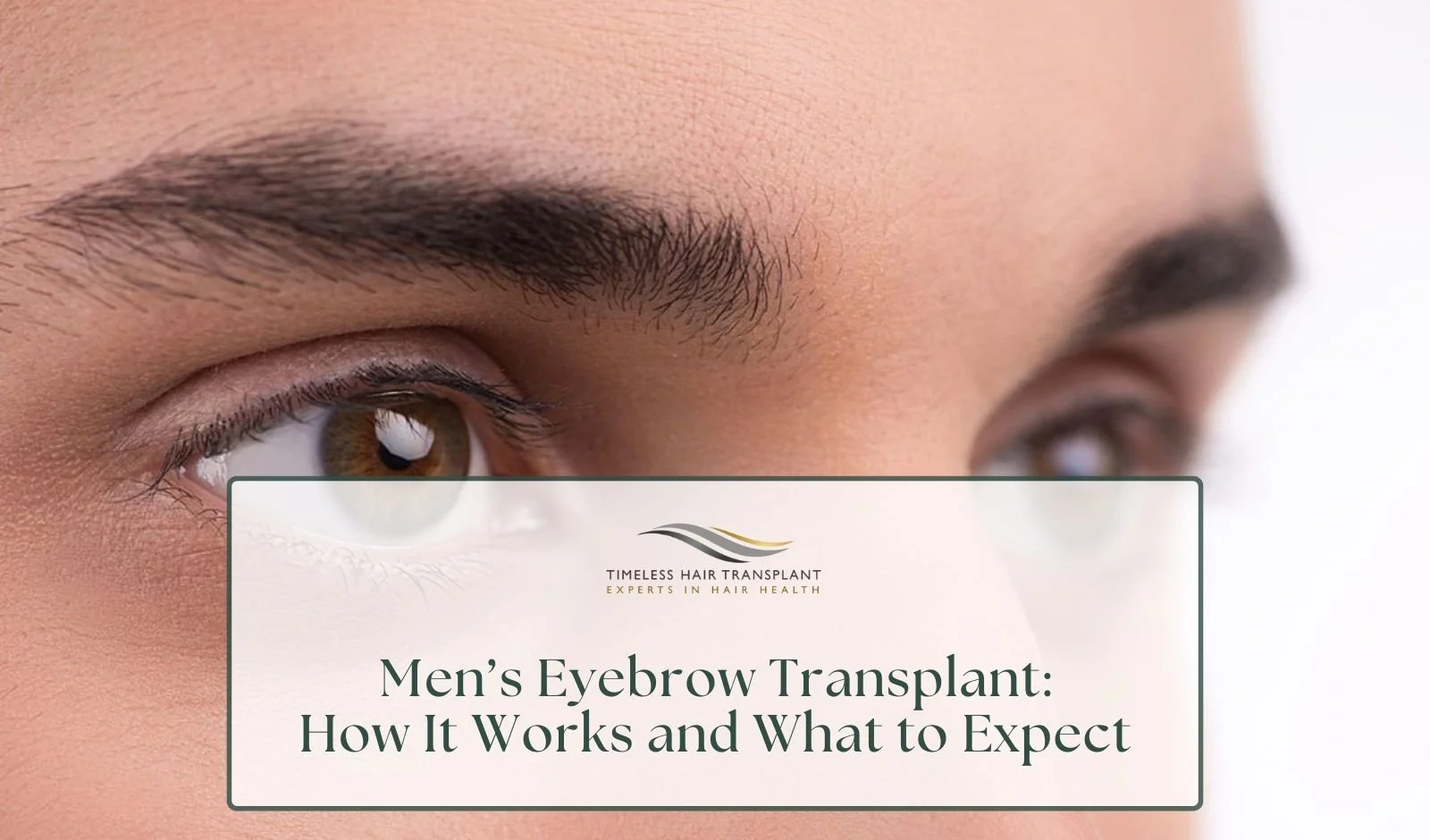 Men’s Eyebrow Transplant How It Works and What to Expect