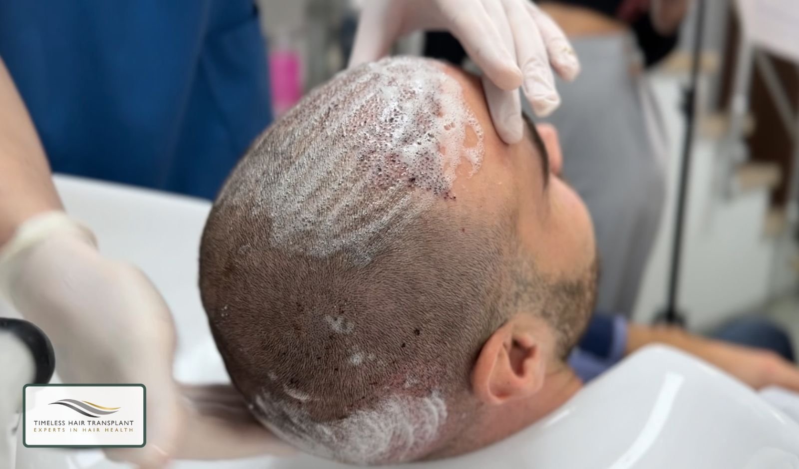 Normal Hair Washing Routine When Is It Safe