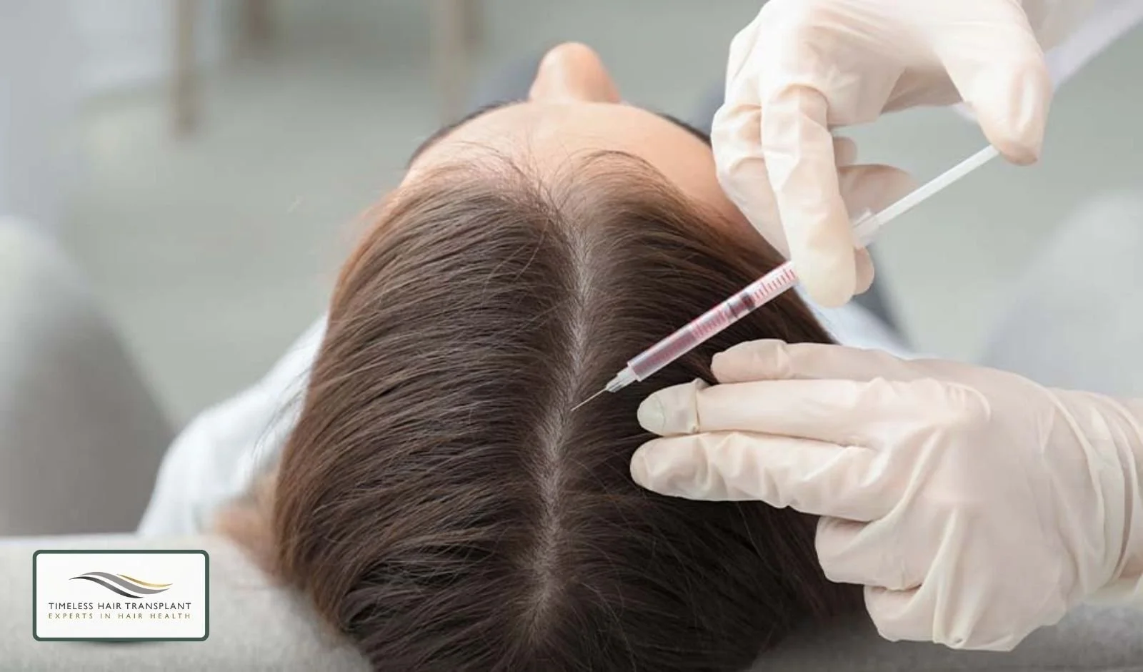 What Is Mesotherapy for Hair