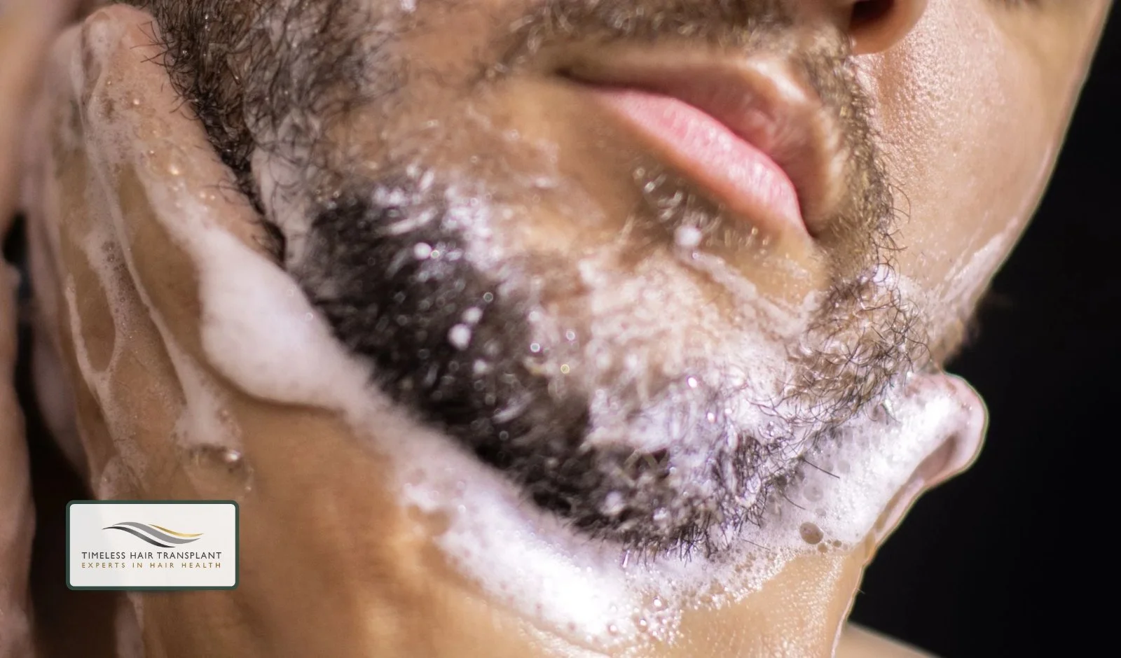 Importance of Aftercare Instructions