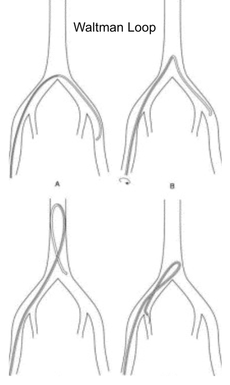 Wires, Catheters, and Sheaths — Learn IR