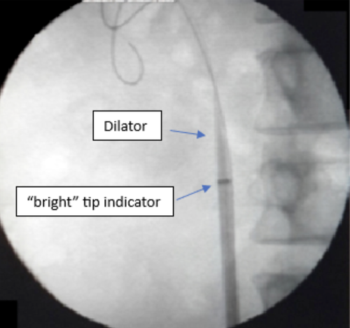 Wires, Catheters, and Sheaths — Learn IR