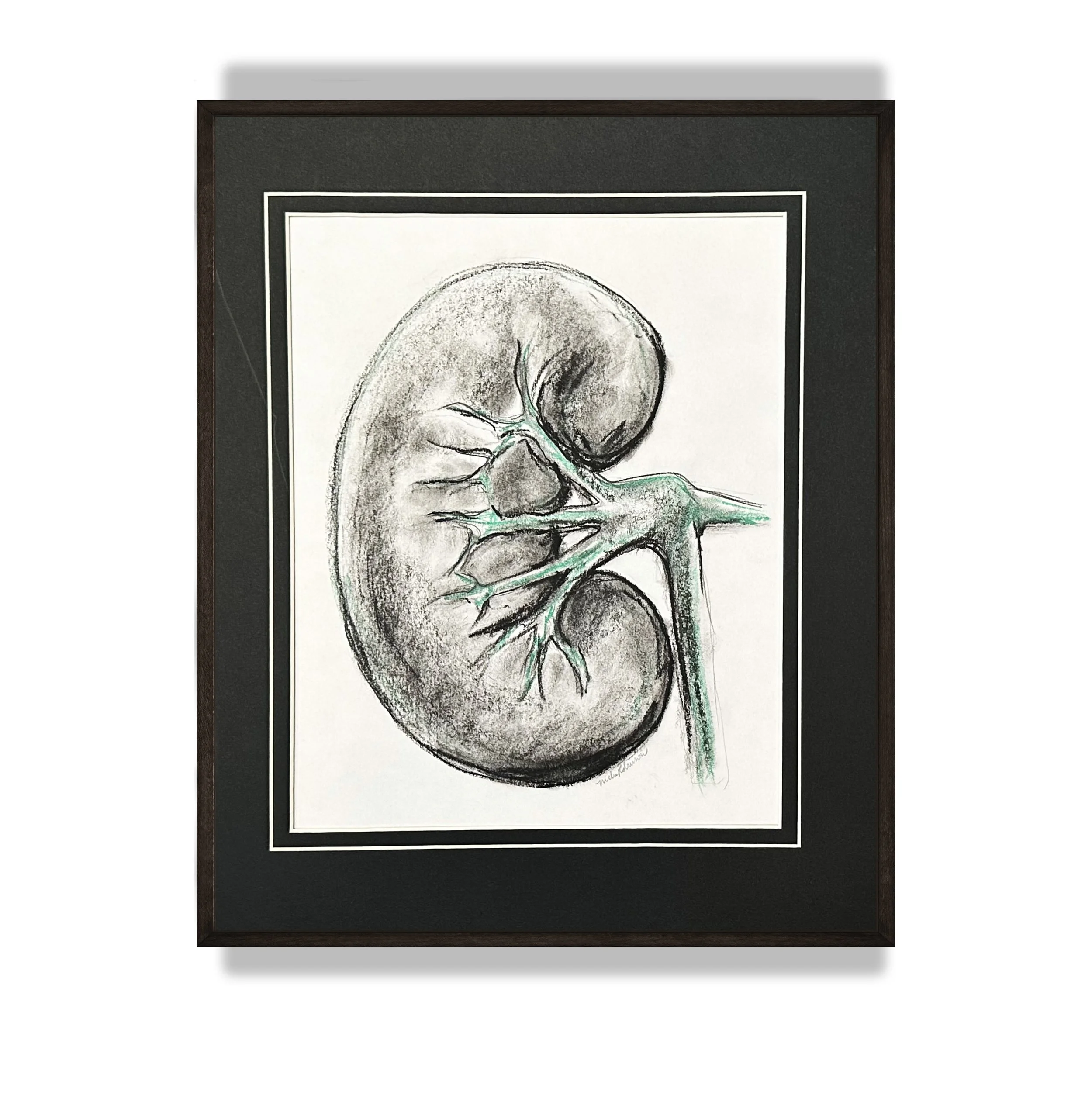 Kidney Mockup 2.jpg