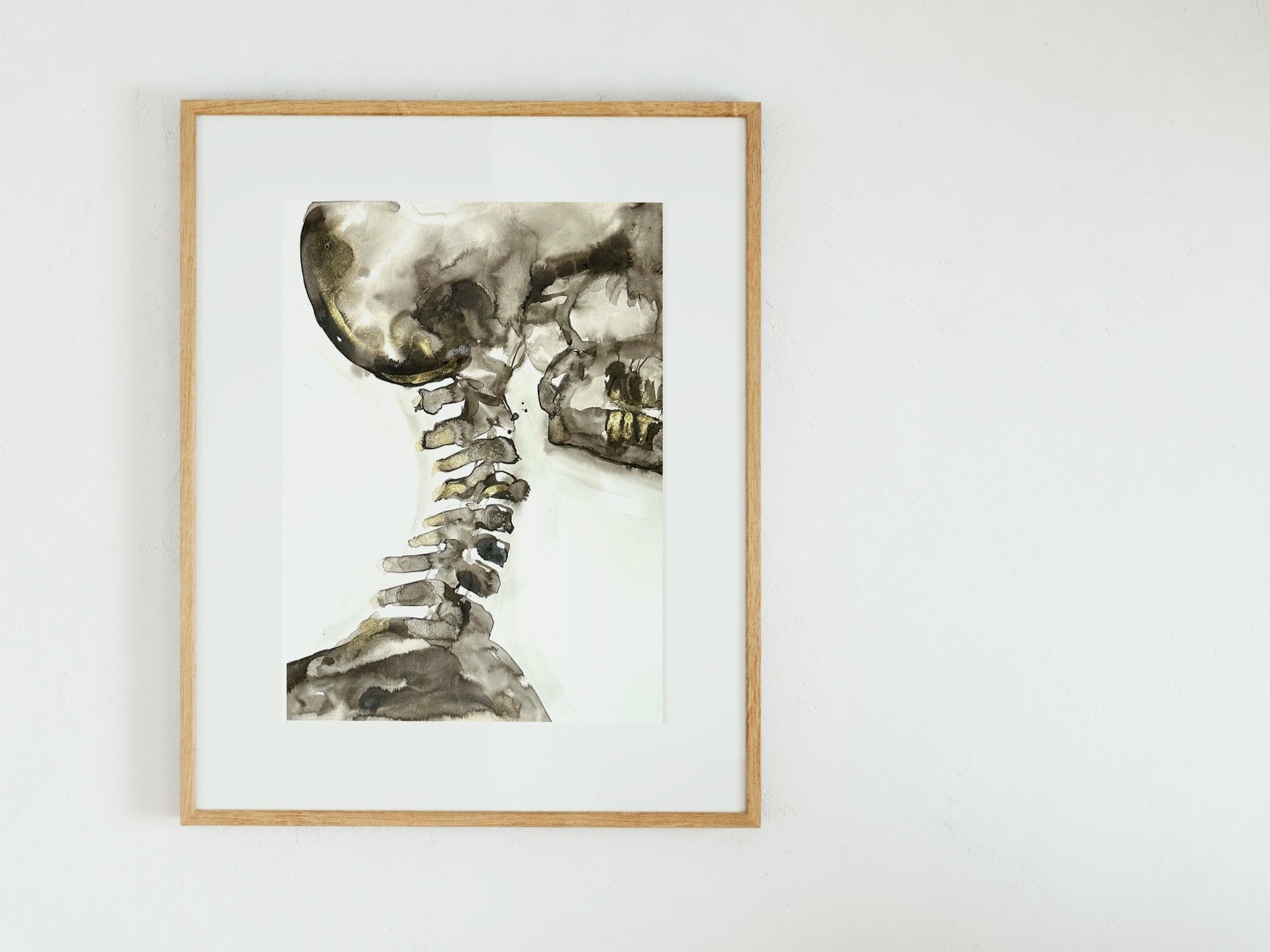 Cervical%2BXRay%2BMockup%2B2.jpg