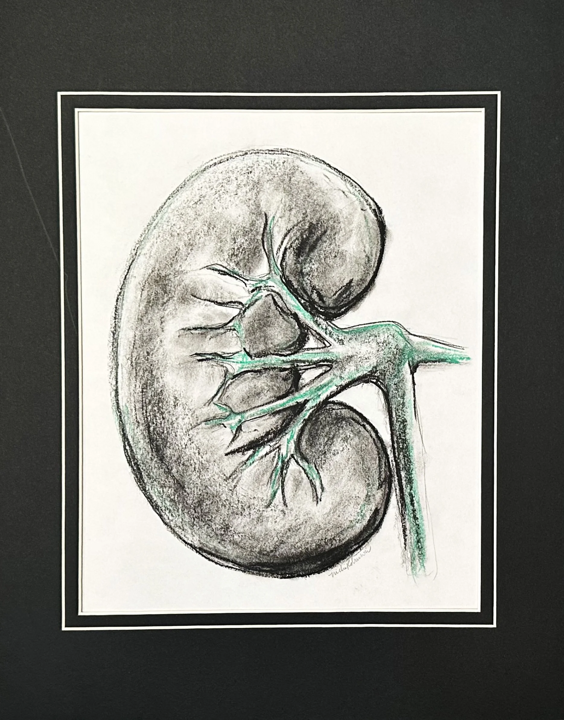 Kidney with Green.jpg