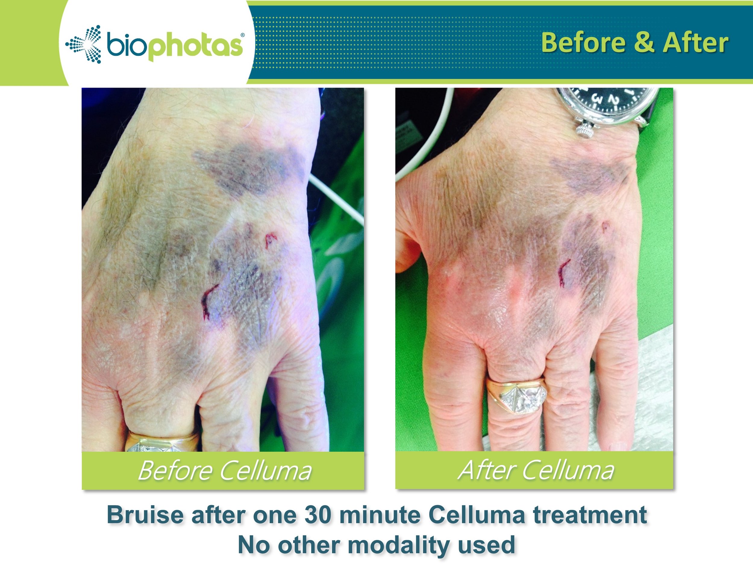 celluma 3.jpg