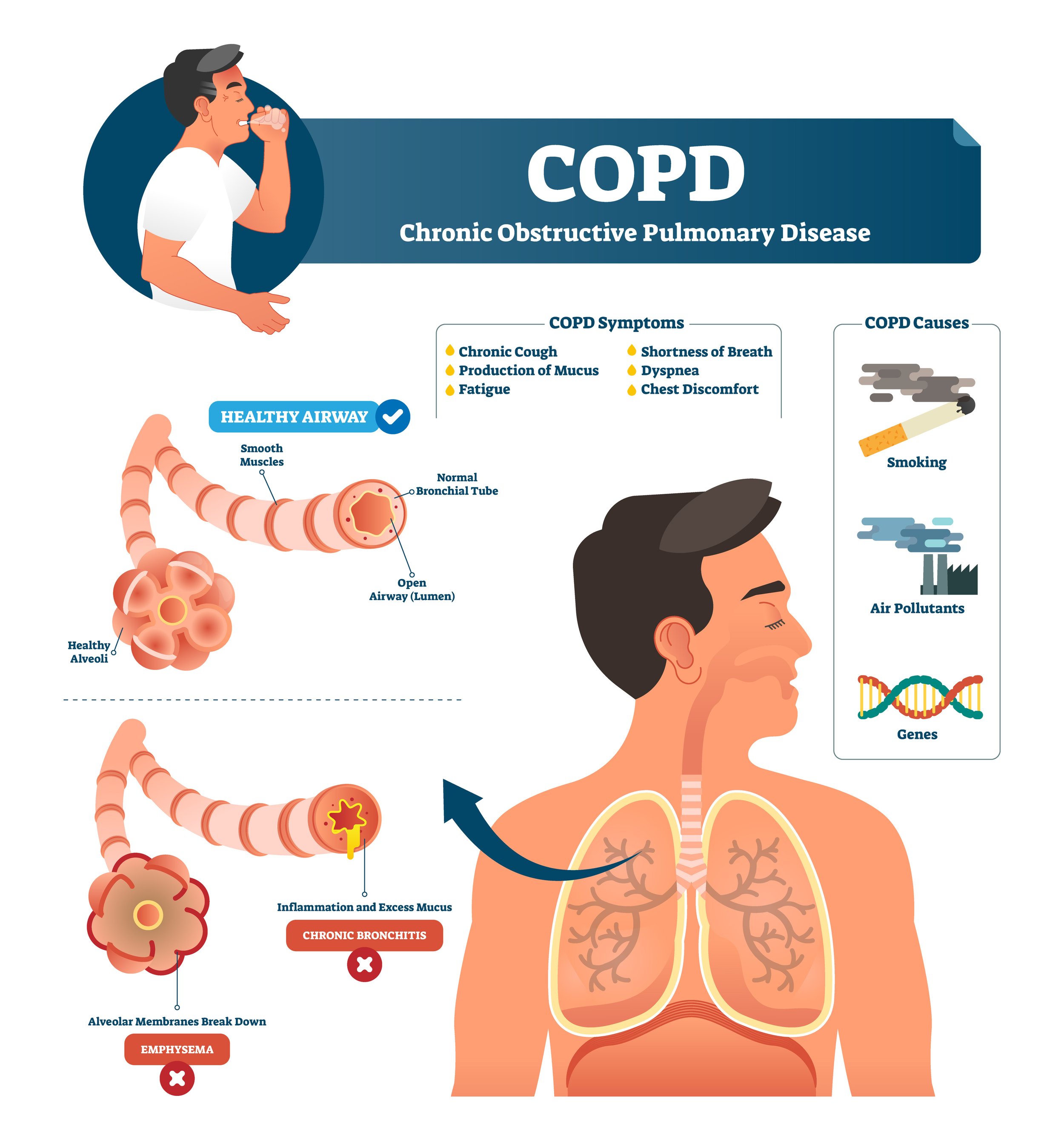 About COPD CanBreathe Canterbury Asthma Society Incorporated