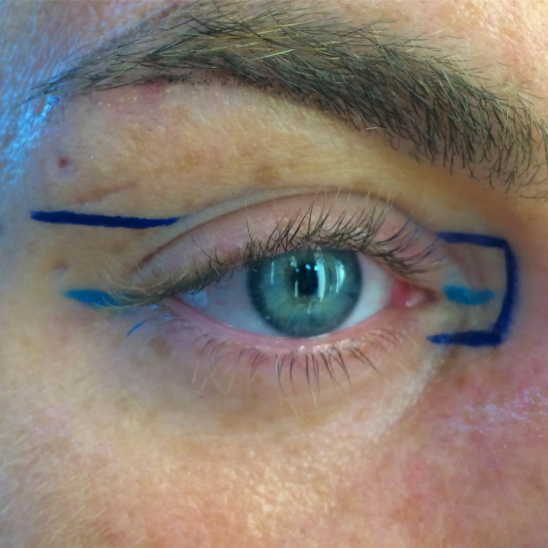 Nahaufnahme eines menschlichen Auges mit blauer Iris und schwarzen Wimpern, umrahmt von markierten Linien auf der Haut rund um das Auge.
