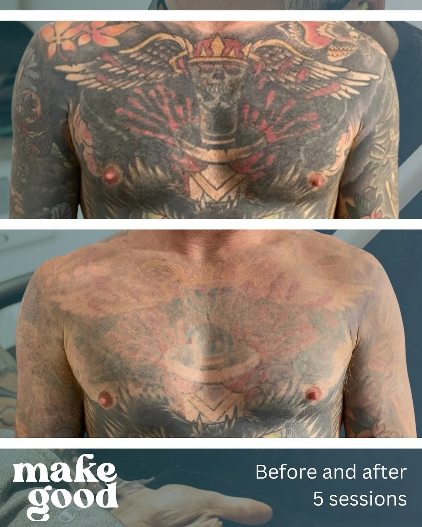 WIP ⚡ 

Update on these super dense pieces. We&rsquo;ve been alternating between arms, chest, legs and back over the past year and making awesome progress. 💪🏼

We&rsquo;re at the tail end of some of these and super keen to see the end results! 

Pl