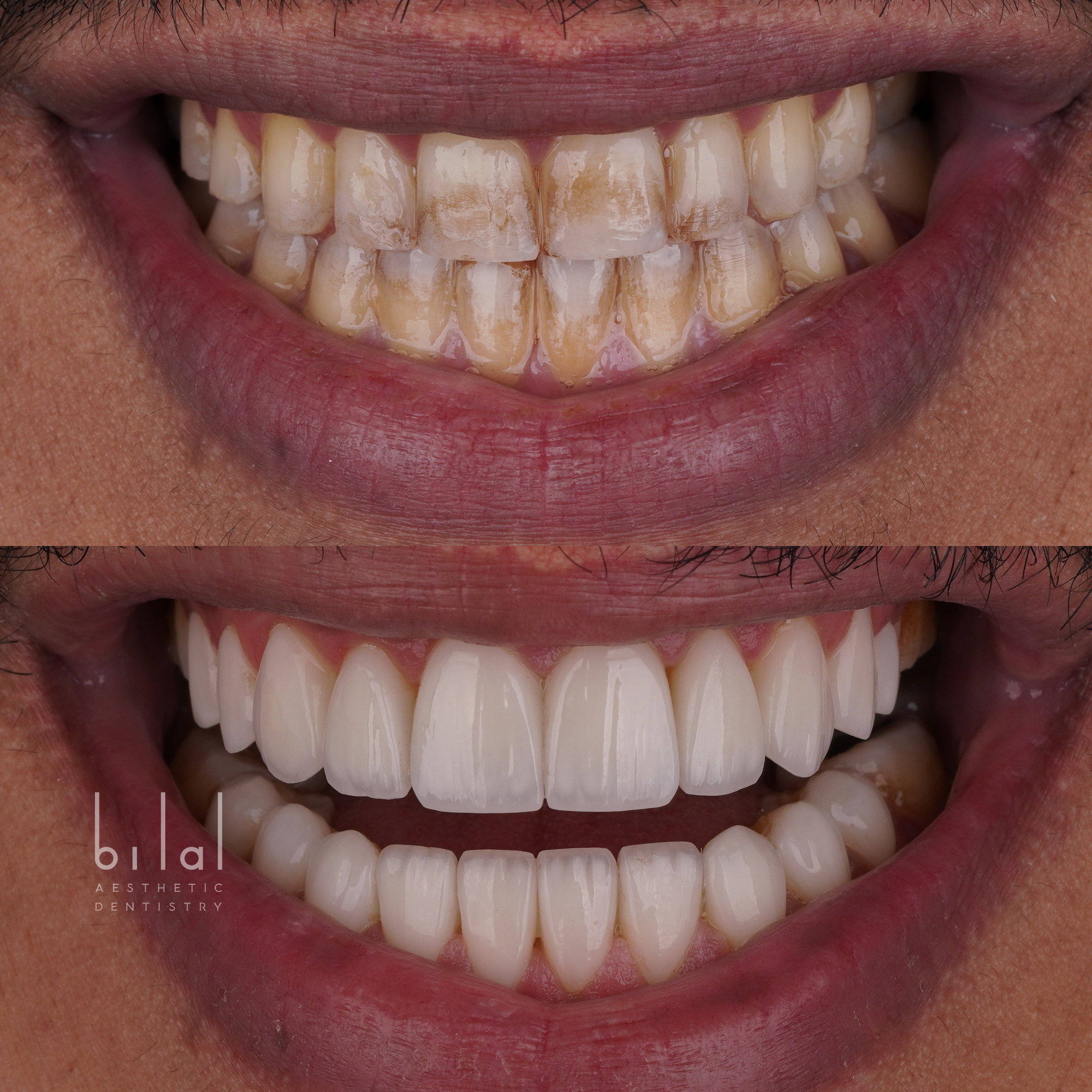 Untitled design.zip - 4.PNG