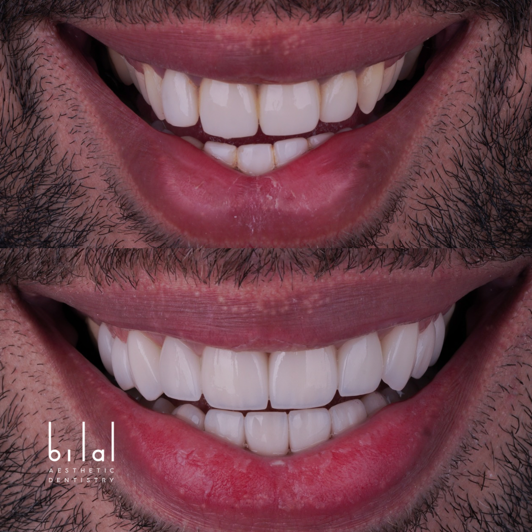 Untitled design 2.PNG